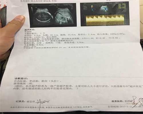 武汉不孕医生讲述子宫肌瘤会影响代孕吗？