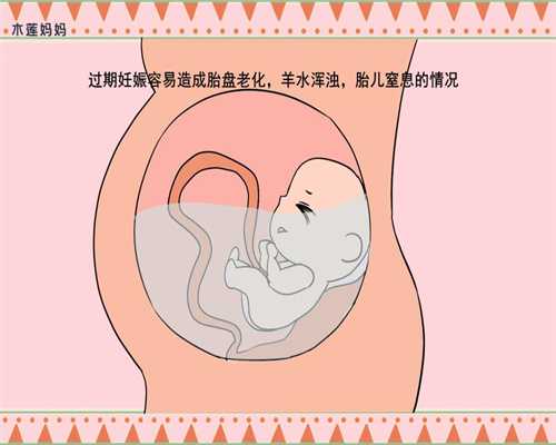 先天性卵巢发育不全引起青春期-借腹生子给多少